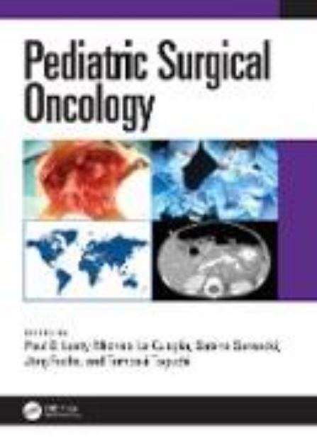 Bild von Pediatric Surgical Oncology (eBook)