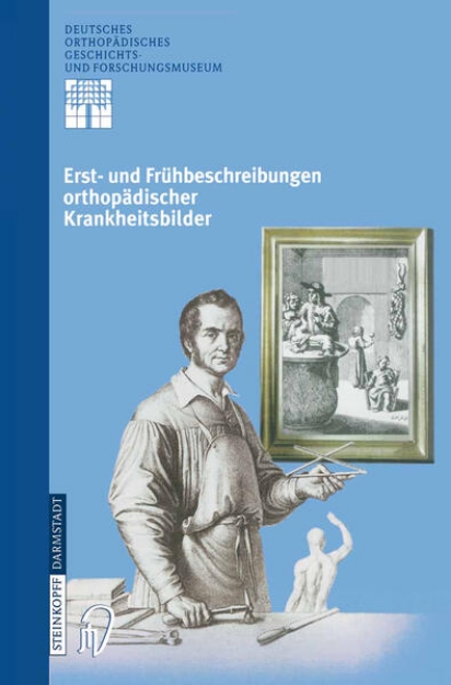 Bild von Erst- und Frühbeschreibungen orthopädischer Krankheitsbilder (eBook)