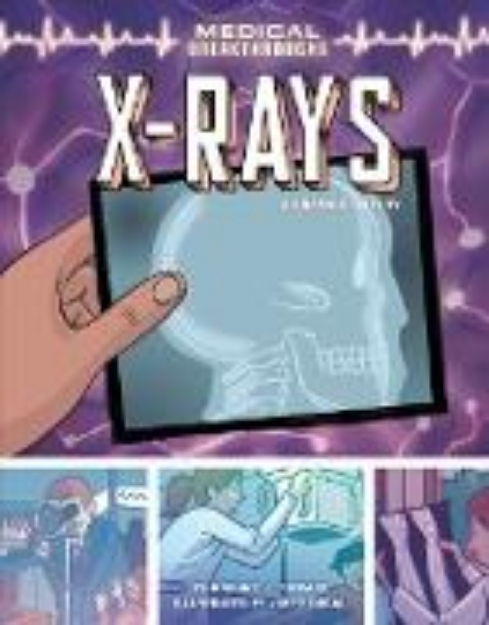 Bild von X-Rays (eBook)