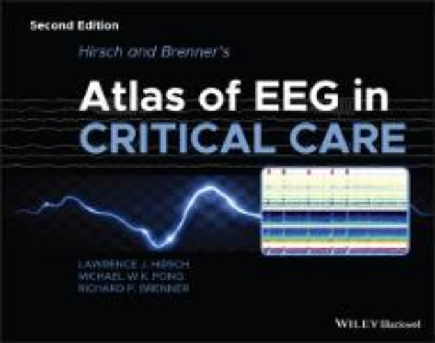 Bild von Hirsch and Brenner's Atlas of EEG in Critical Care (eBook)