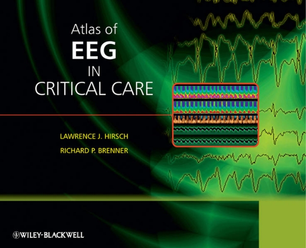 Bild von Atlas of EEG in Critical Care (eBook)