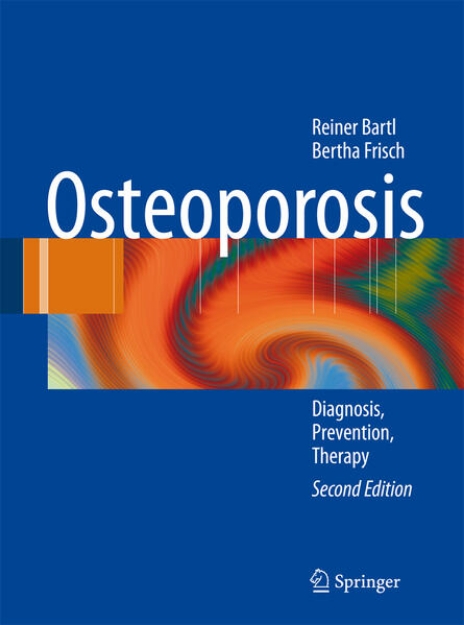 Bild von Osteoporosis (eBook)