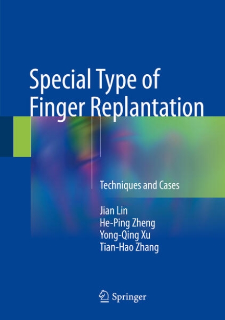 Bild von Special Type of Finger Replantation (eBook)