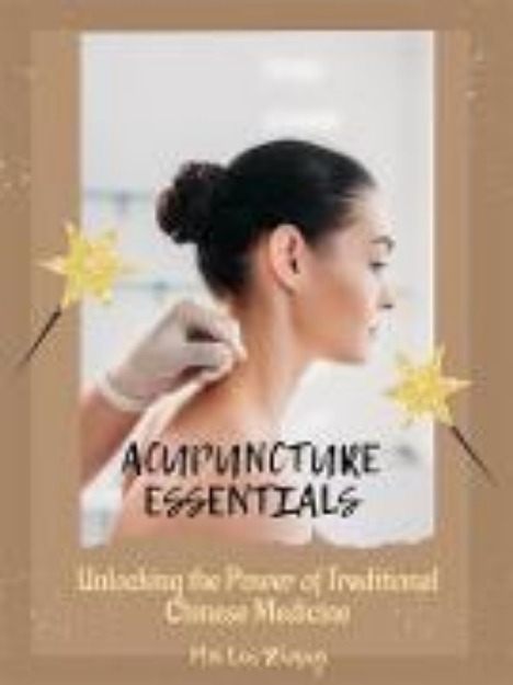 Bild von Acupuncture Essentials (eBook)