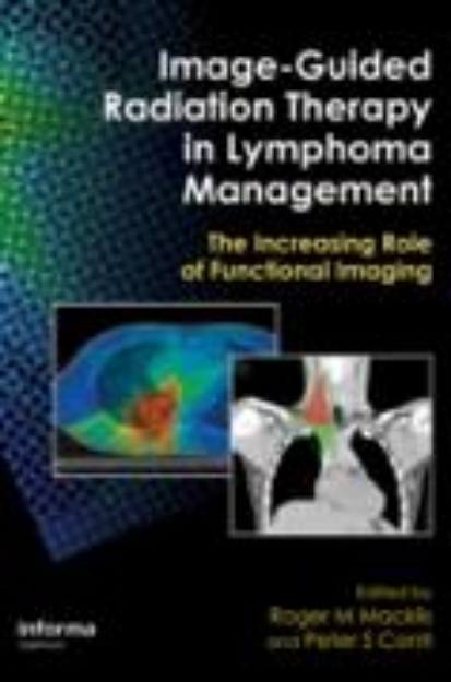 Bild von Image-Guided Radiation Therapy in Lymphoma Management (eBook)