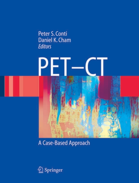 Bild von PET-CT (eBook)