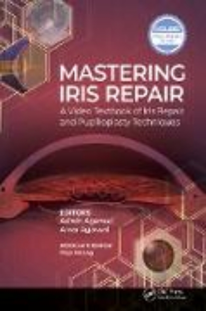 Bild von Mastering Iris Repair (eBook)