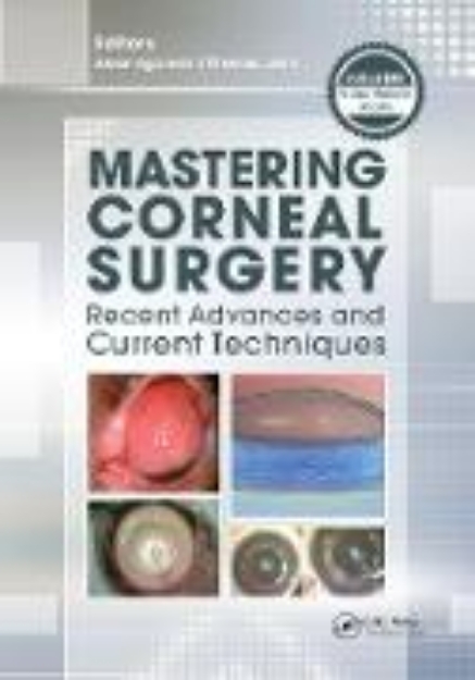 Bild von Mastering Corneal Surgery (eBook)