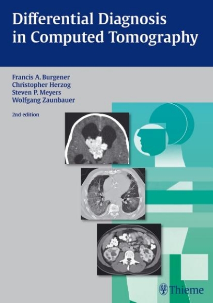 Bild von Differential Diagnosis in Computed Tomography (eBook)