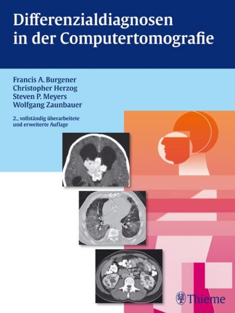 Bild von Differenzialdiagnosen in der Computertomografie (eBook)