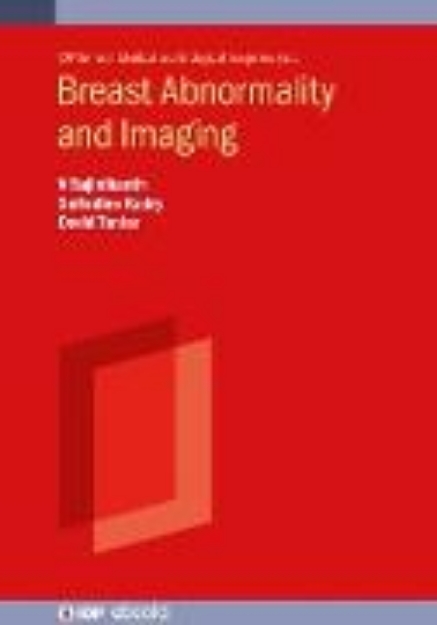 Bild von Breast Abnormality and Imaging (eBook)