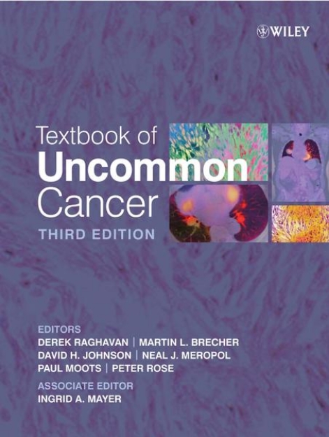 Bild von Textbook of Uncommon Cancer (eBook)