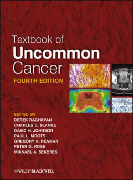 Bild von Textbook of Uncommon Cancer (eBook)