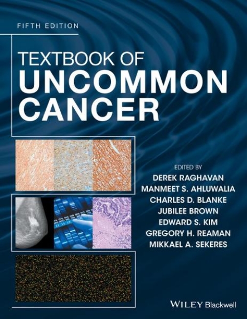 Bild von Textbook of Uncommon Cancer (eBook)