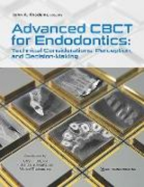 Bild von Advanced CBCT for Endodontics (eBook)